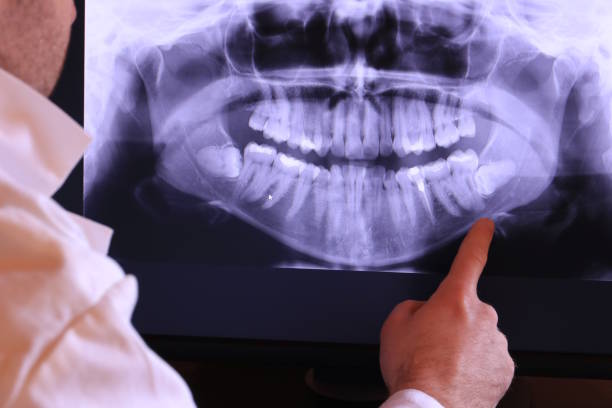 Best Emergency Root Canal Treatment in Newcastle, WA
