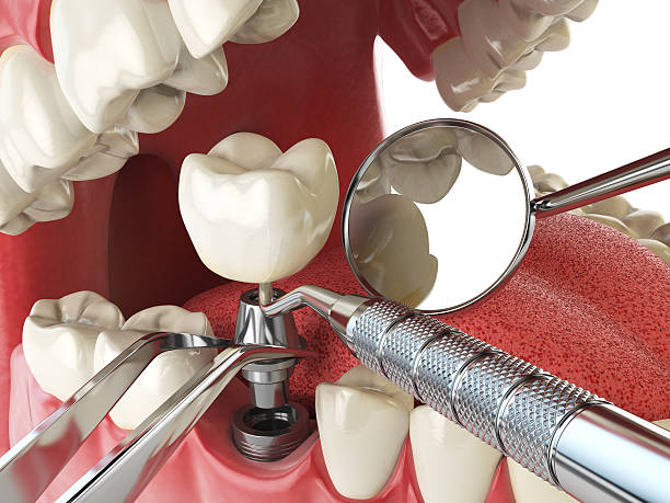 Best Weekend Emergency Dentist in Newcastle, WA